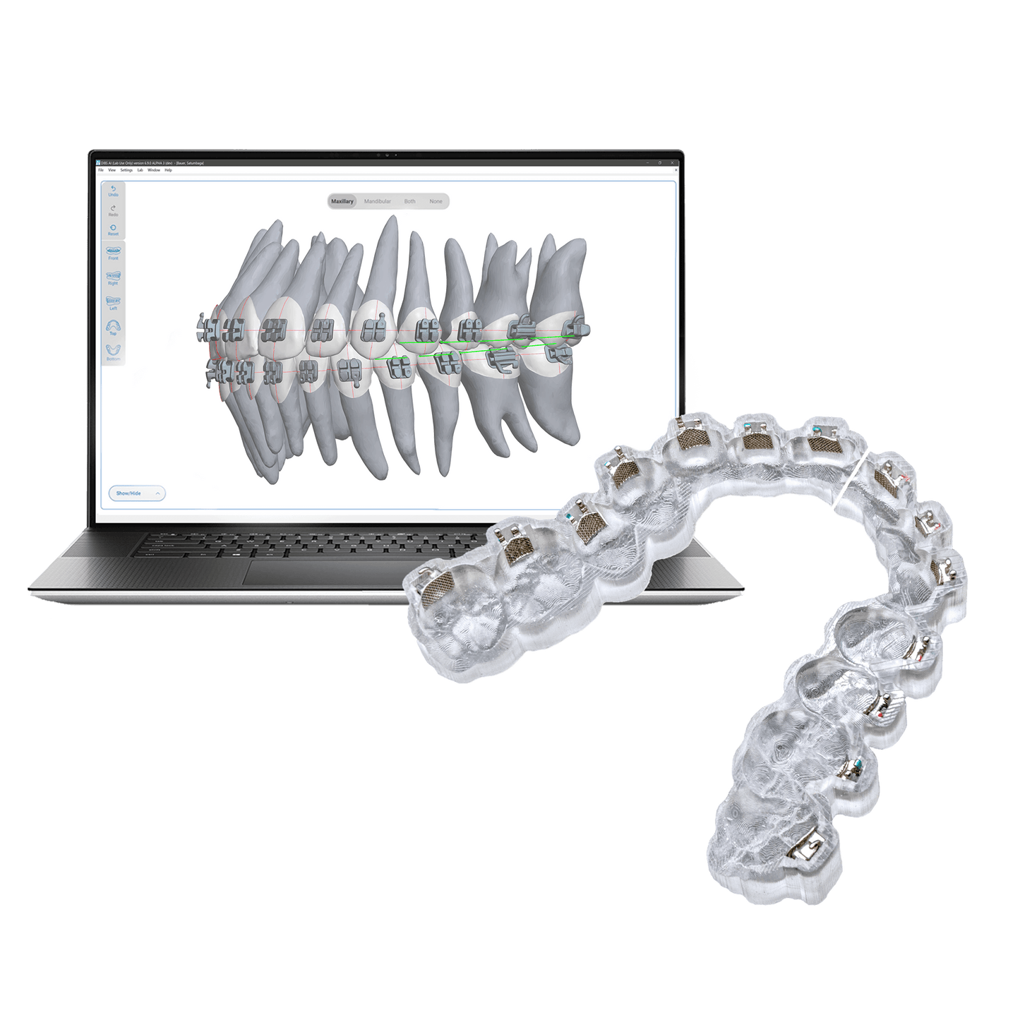 DIBS AI - Starter Pack